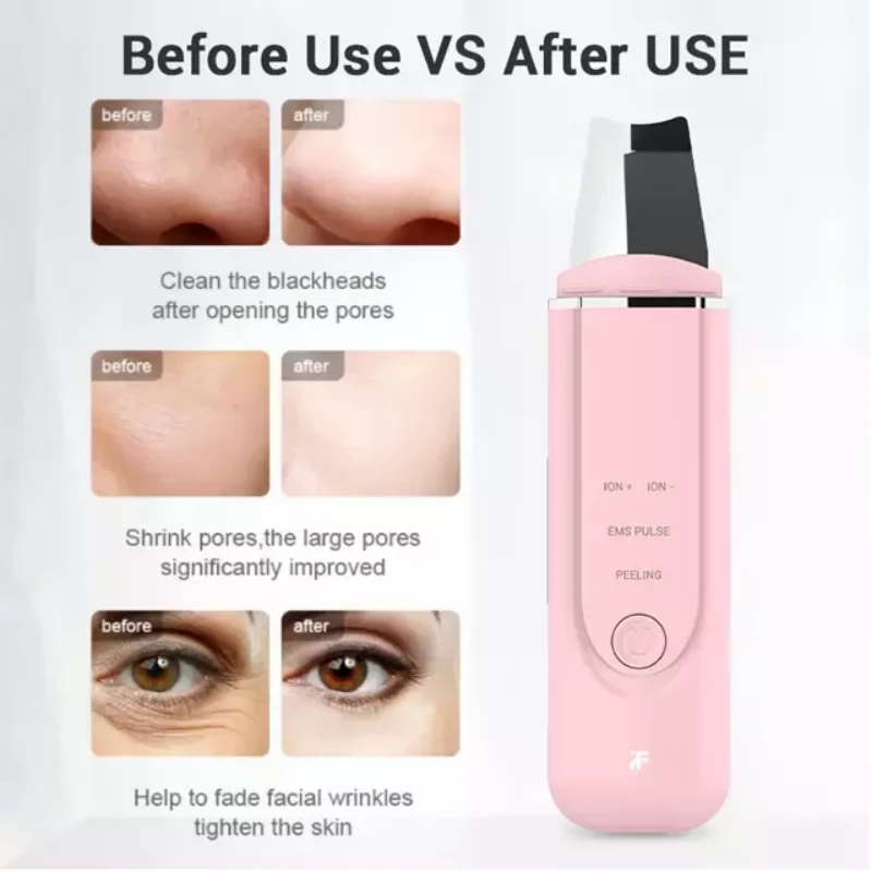Xiaomi MS7100 InFace Ultrasonic Ionic Cleaner.1